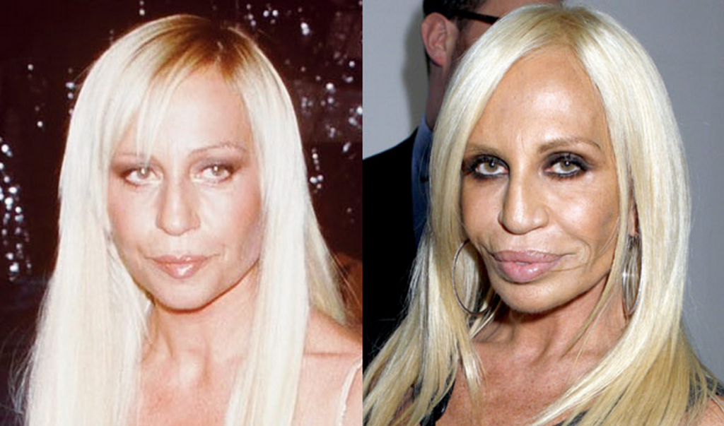 donatella-versace-estetik